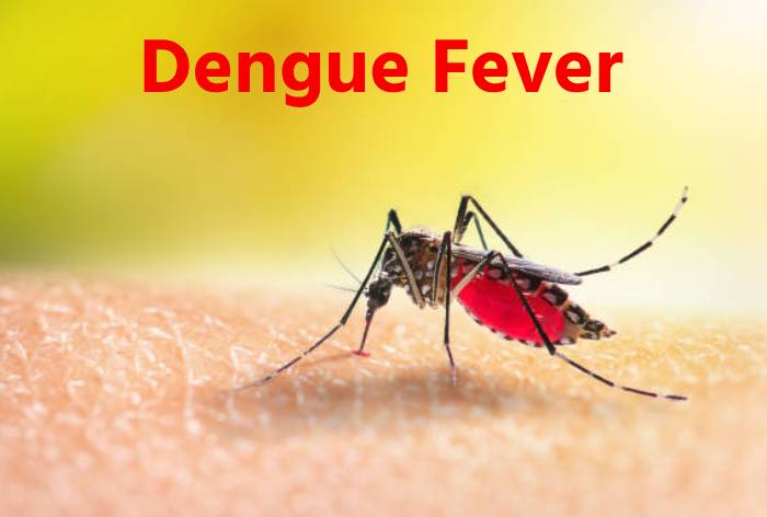 डेंगू ज्वर (Dengue Fever)